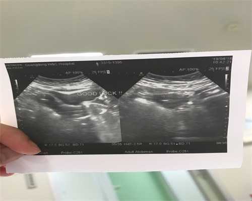 女性艾滋病试管成功案例分享？艾滋病试管成功率--代怀生男孩