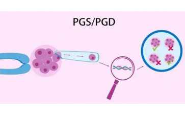 抑那通和达菲林的价格区别：(抑那通和达菲林的副作用对比)--代妈应聘