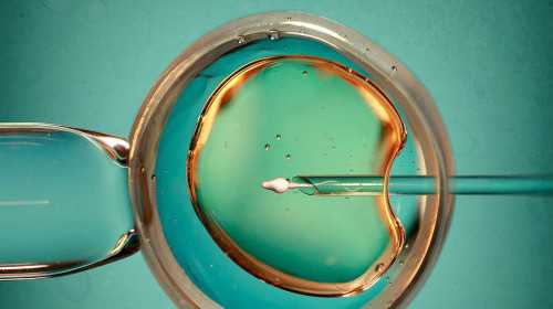 国内代生儿子中心,试管婴儿借卵代生选择男女的费用是多少？