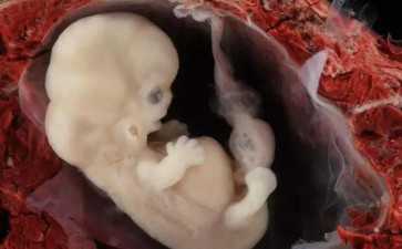 国内供卵多少钱一颗,别纠结促排期能否吃猕猴桃了，想卵子好一天吃几个才是关键