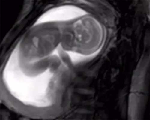 中国国内供卵价格多少,做试管婴儿为什么很贵(为什么有的人做试管要花十几万)