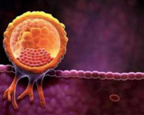 国内正规代生中心,多囊卵巢症能做试管婴儿吗 具体试管步骤看这里