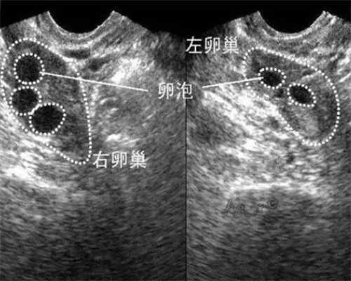 国内供卵代生机构有哪些,做试管婴儿可以泡脚吗？做试管婴儿移植后可以泡脚吗？