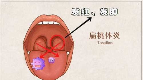 试管移植14天抽血检查hcg达到1000怀的是双胞胎吗？
