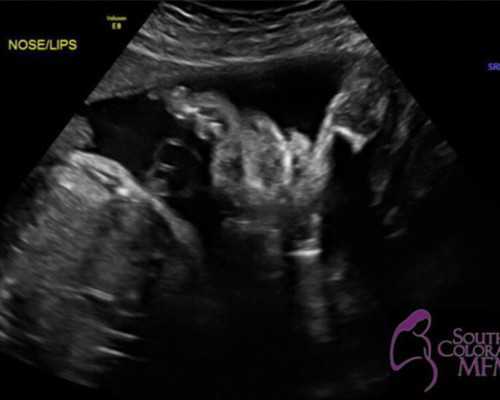 国内正规借卵代孕公司,国内第三代试管婴儿包生儿子多少钱，附费用明细！