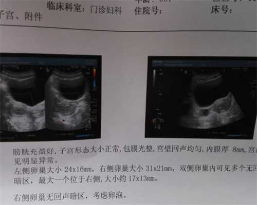 武汉锦欣一代试管费用--哪做代怀好