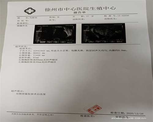 艾滋病患者用洗精术，洗精术生孩子方法--助孕零风险